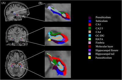 The Volume of Hippocampal Subfields in Relation to Decline of <mark class="highlighted">Memory Recall</mark> Across the Adult Lifespan